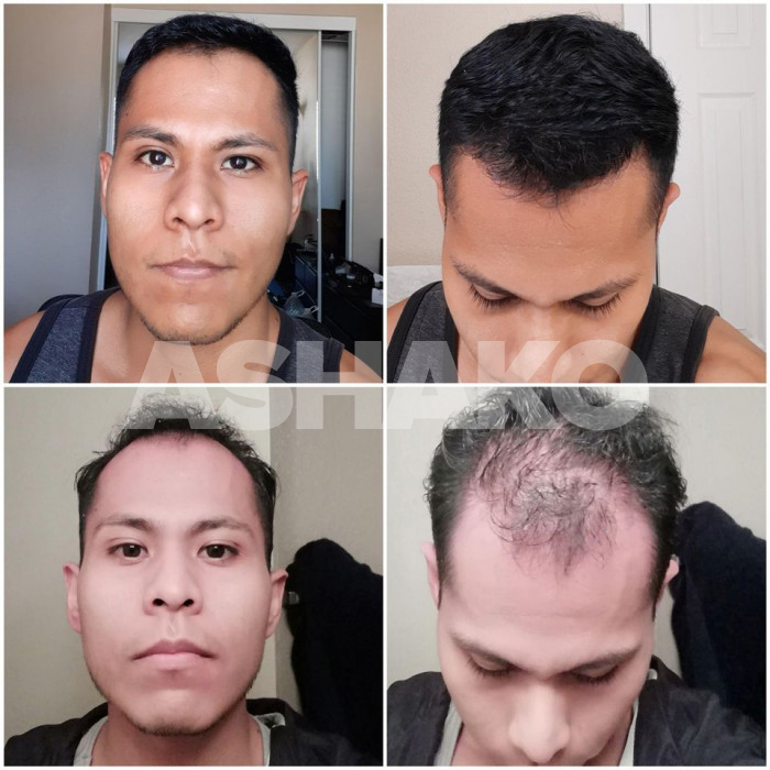 LAHI KA BA NG PANOT MANIPIS AND BUHOK !  PME MOKO MAY SOLUSYON AKO JAN !!